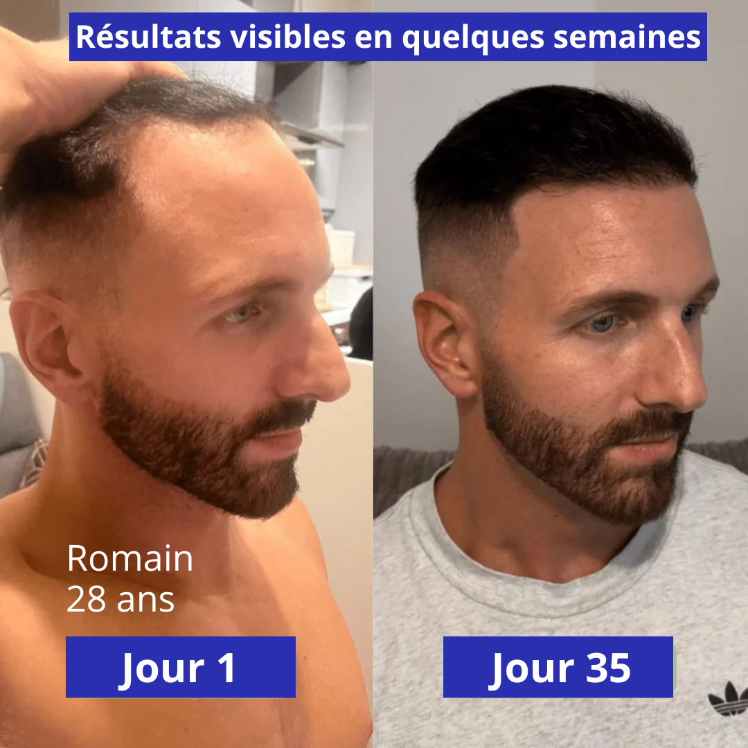 HairPlus (bodywise) - Sérum Anti-Chute & Pousse de Cheveux