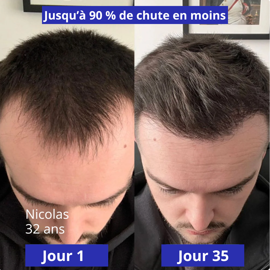 HairPlus (bodywise) - Sérum Anti-Chute & Pousse de Cheveux